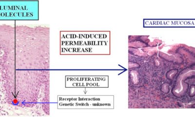 Function of Squamous Epithelium