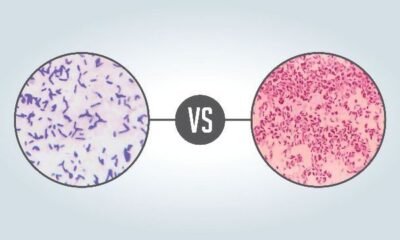 Difference Between Gram Positive and Gram Negative Bacteria