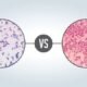 Difference Between Gram Positive and Gram Negative Bacteria